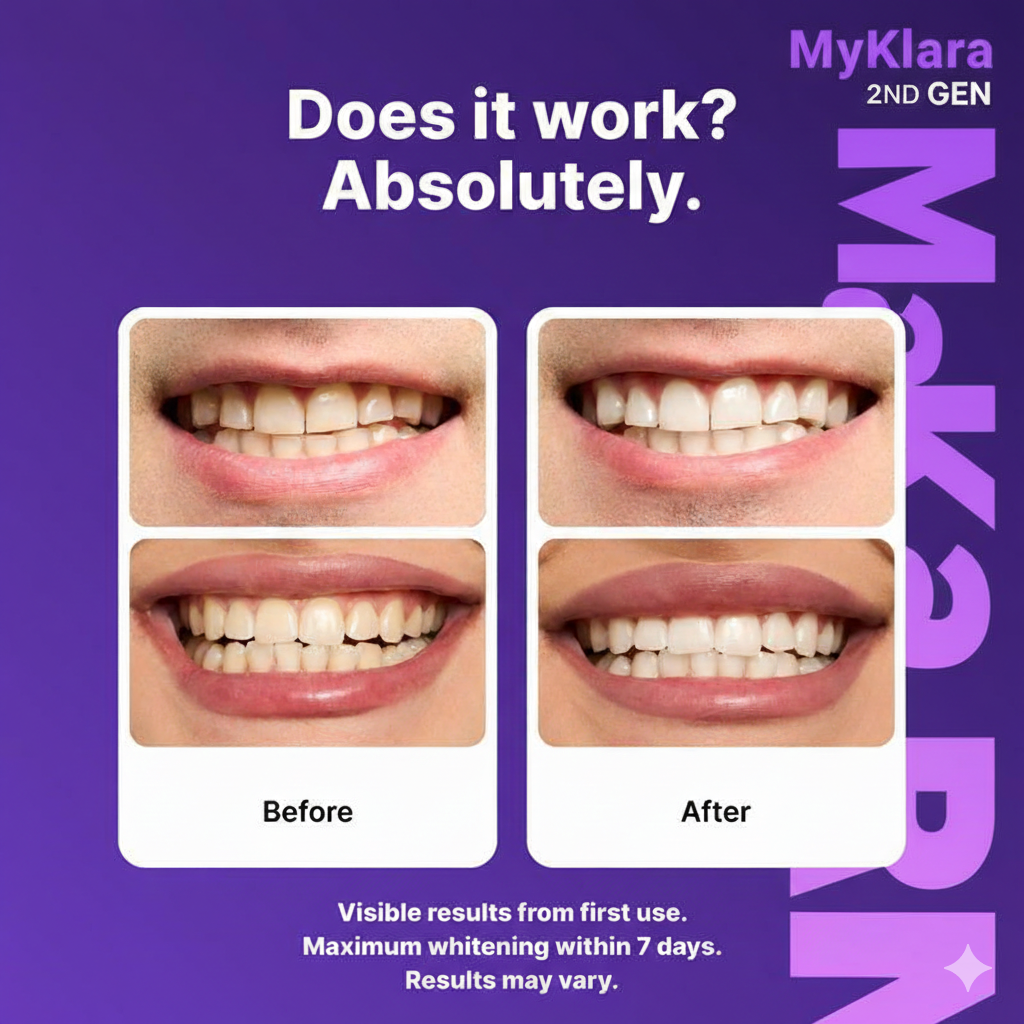 MyKlara - Purple Whitening Strips
