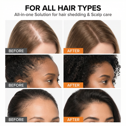 Korea's #1 Hair Growth Secret: Klara Growth Ampoule
