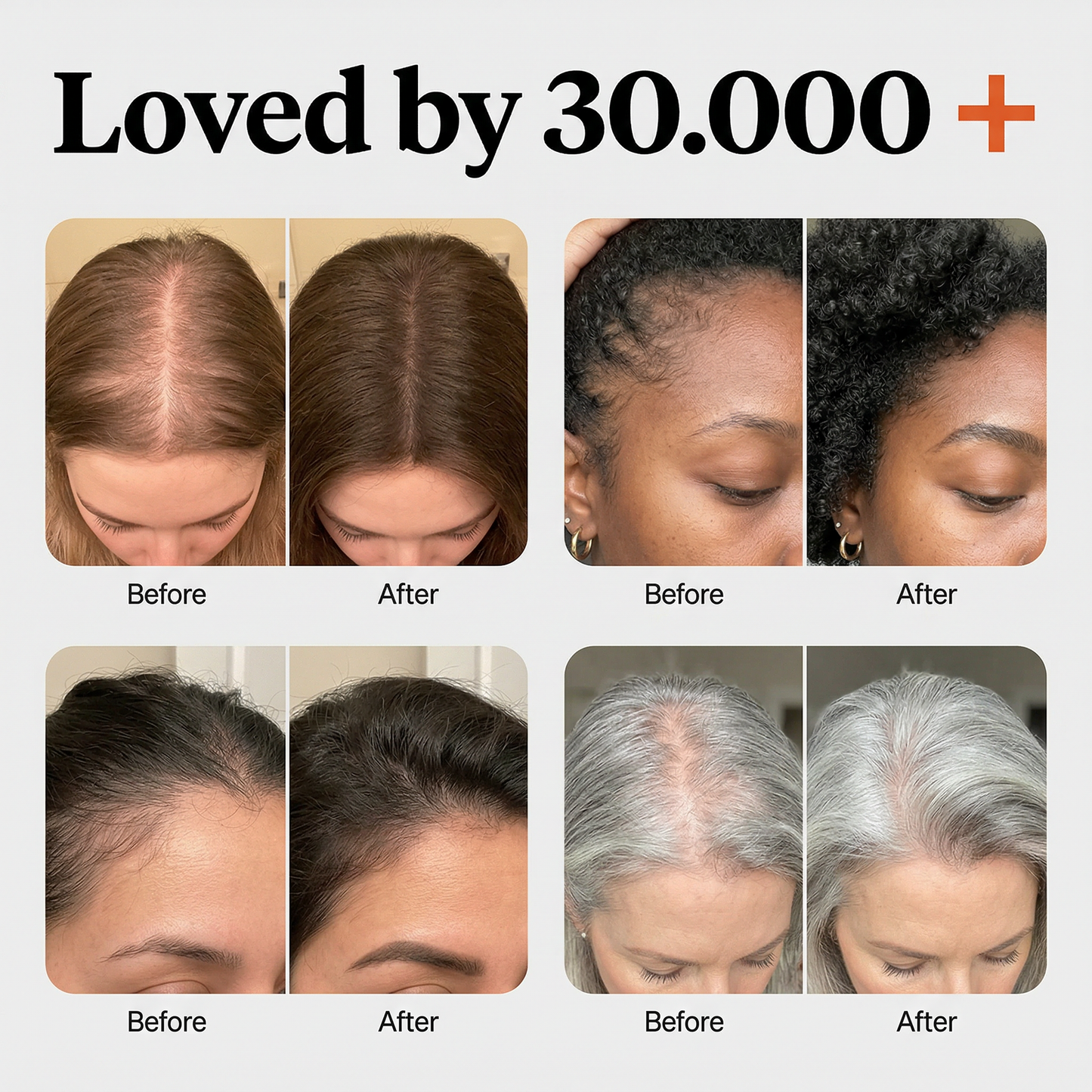 Korea's #1 Hair Growth Secret: Klara Growth Ampoule