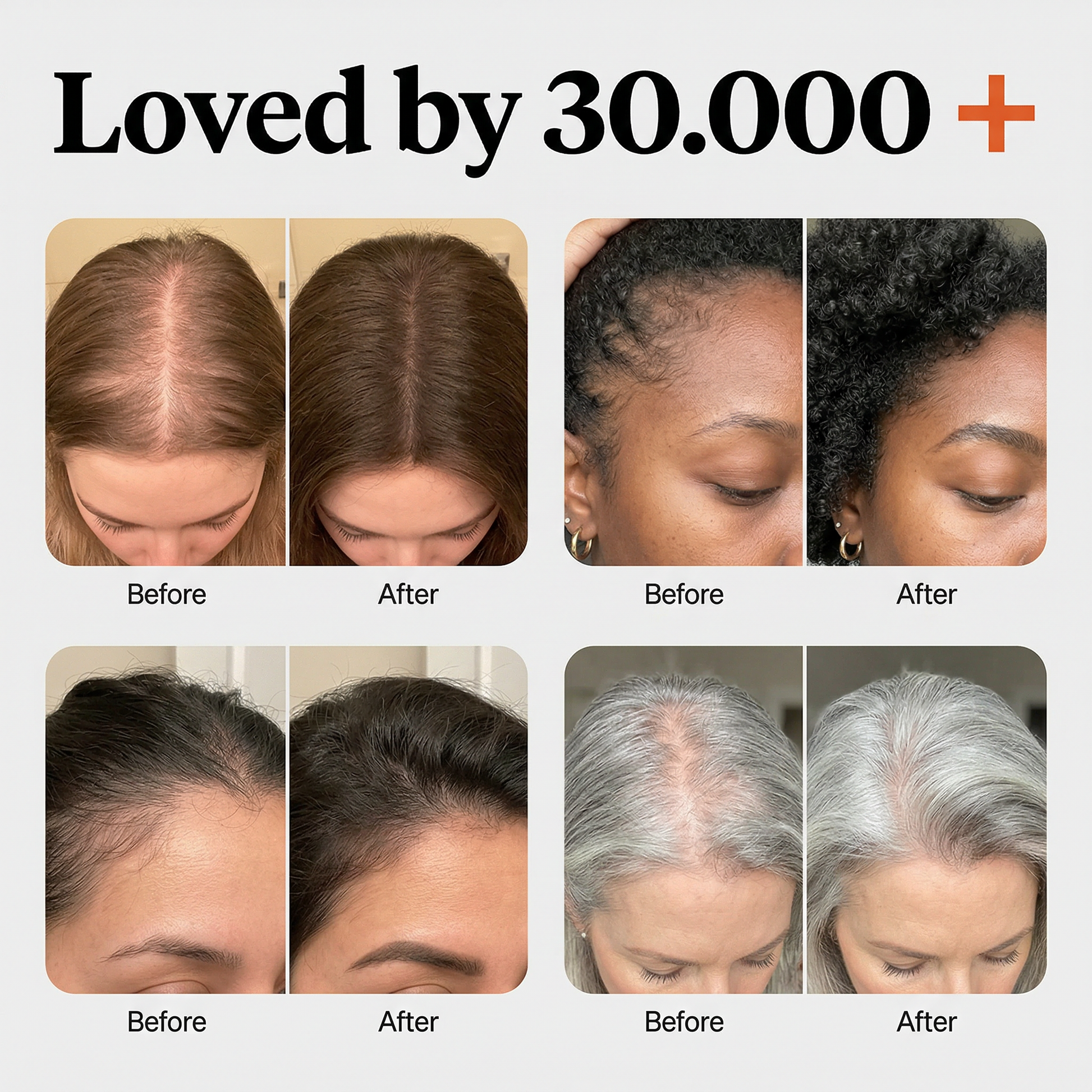 Korea's #1 Hair Growth Secret: Klara Growth Ampoule